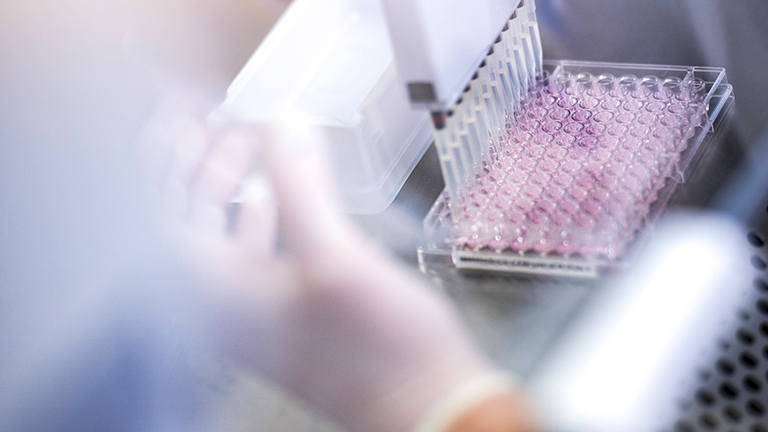 Virusproben werden im Labor analysiert.