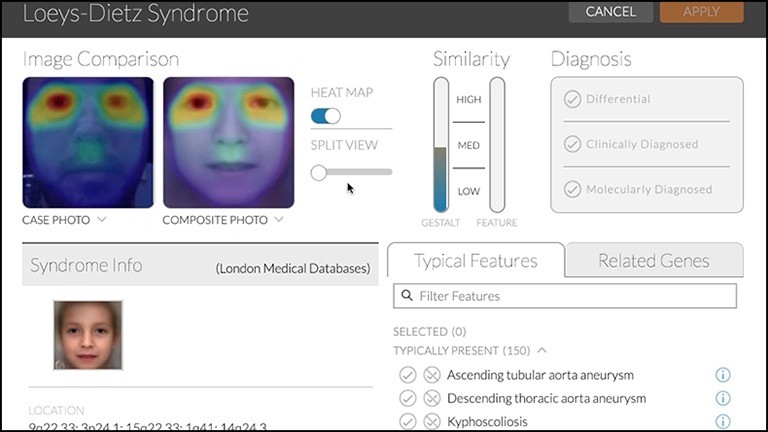 Screenshot der App Face2Gene