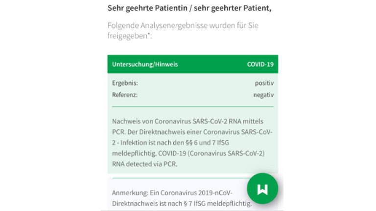 PCR-Test Testergebnis