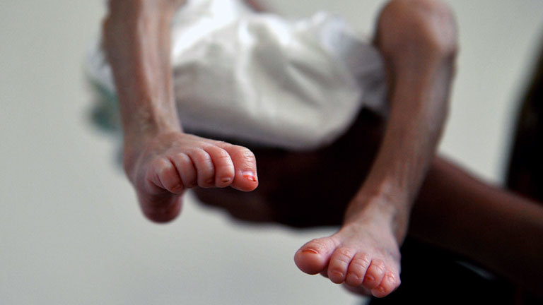 Uno warnt vor massiver Hungersnot im Jemen