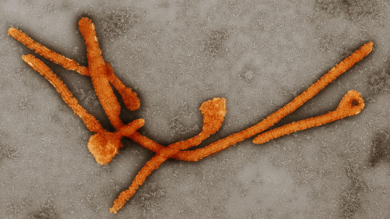 Das Ebolavirus in 1000facher Vergrößerung.
