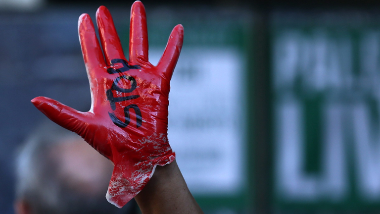 Ein Demonstrant hält am 07.08.2014 in einer Demonstration gegen den Gazakrieg seine blutrote Hand hoch. Auf ihr steht "Stop".