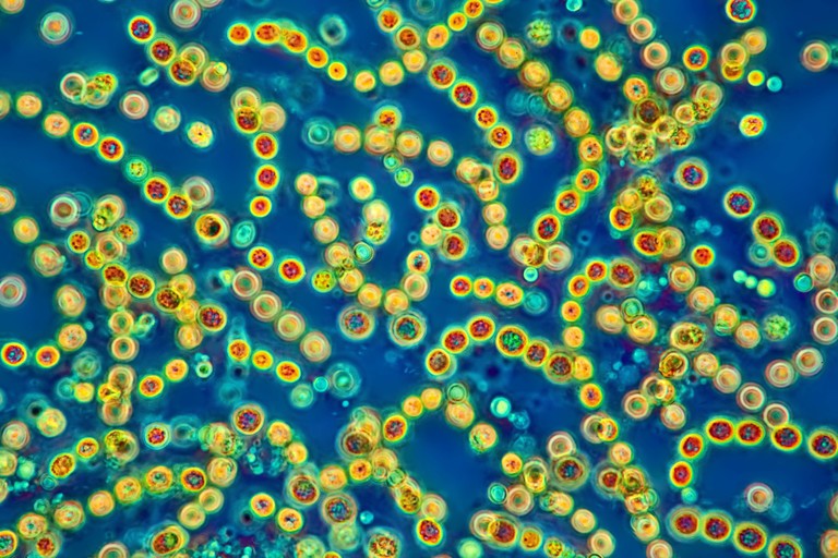 Cyanobakterien unter einem Lichtmikroskop. Eine Reihe von gelb umrandete Zellen.