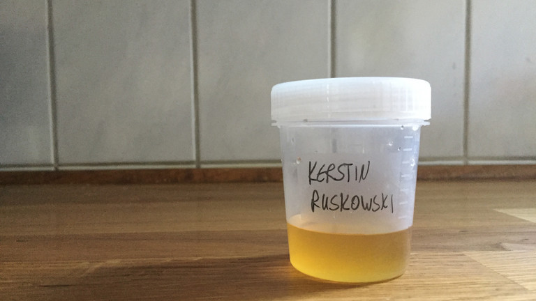 Urinprobe von Kerstin Ruskowski