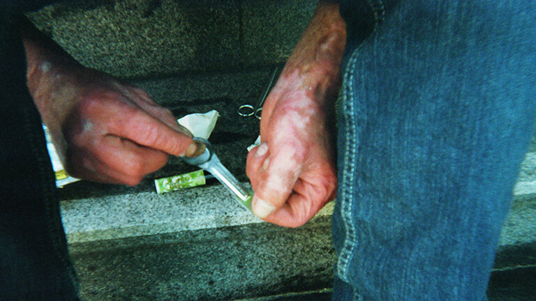 Analoge Fotografie aus dem Projekt "(Über)Leben im Risikoumfeld": Nahaufnahme der geschunden aussehenden Hände eines Mannes, der Jeanshosen trägt und auf einer Steintreppe sitzt, die einen metallenen Löffel halten, um Crack zu kochen. Unter den Händen liegen weitere Dinge, erkennbar sind ein Feuerzeug und eine Schere.