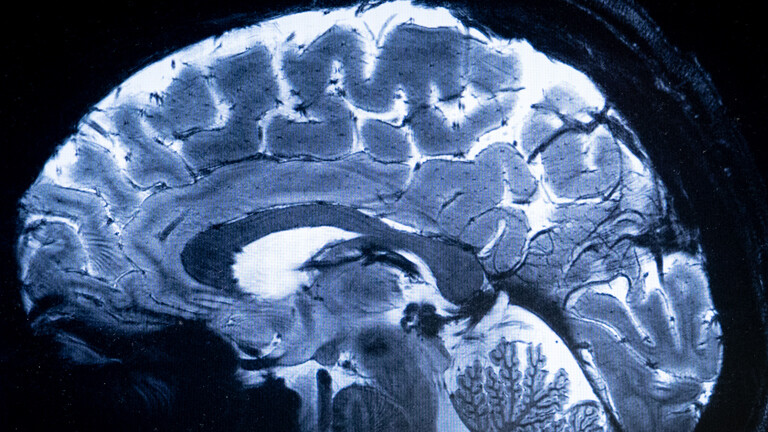 Ein Gehrirnscan