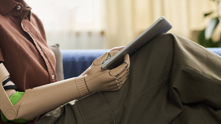 Mädchen mit Armprothese, das ein Tablet benutzt, Symbolfoto.