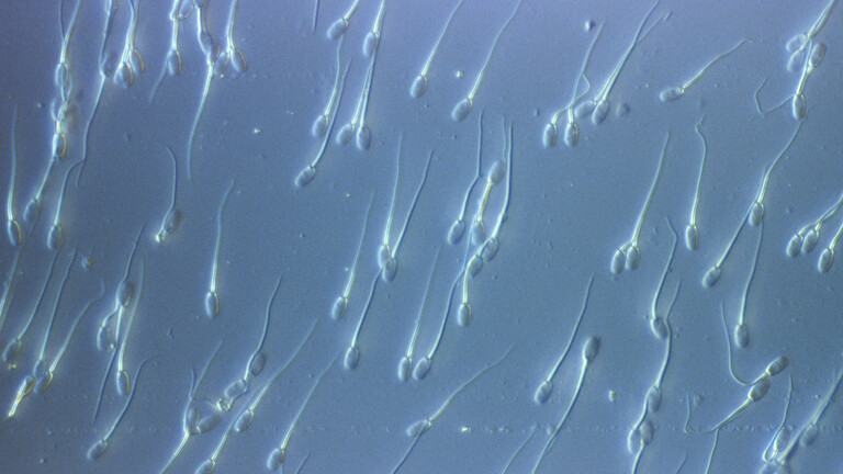 Männliche Spermien unter dem Mikroskop