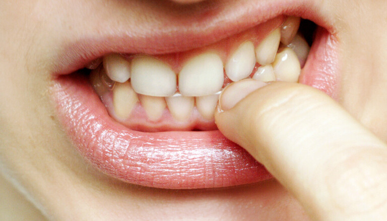 Nahaufnahme eines Mundes und eines Fingers, an dessen Nagel gekaut wird