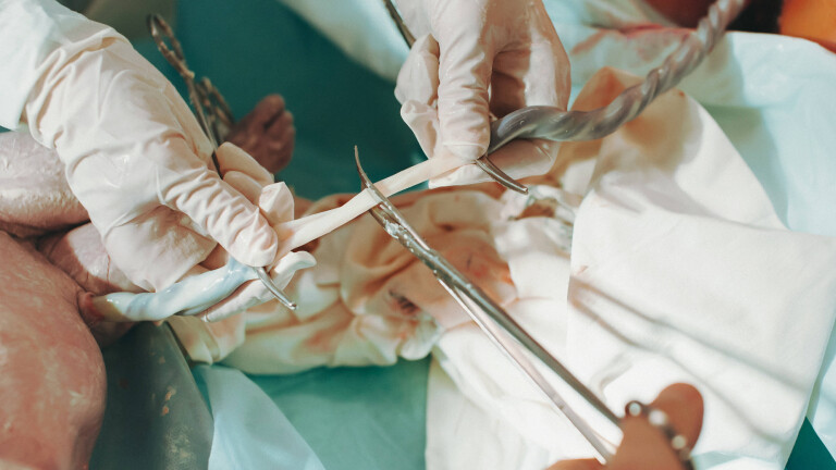 Erste Bindung und dann direkt das Ende: Hier wird unmittelbar nach der Geburt die Nabelschnur eines Neugeborenen durchtrennt.