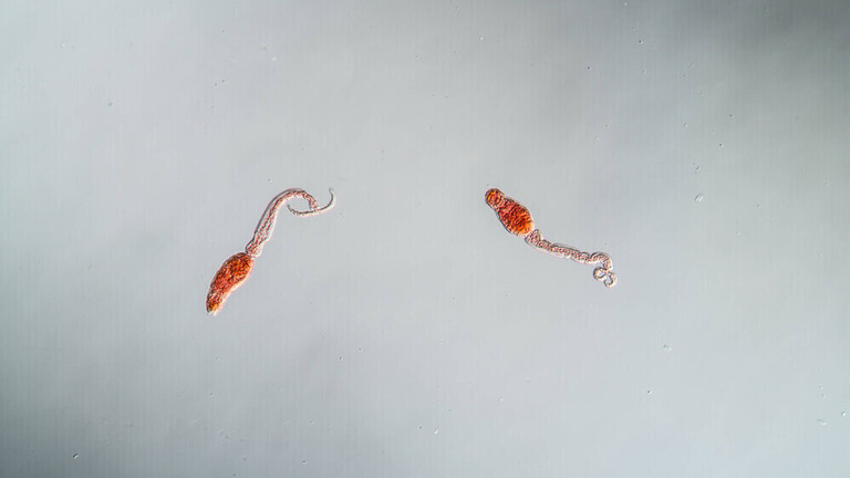 Mikroskopische Aufnahme von Bilharziose-Erregern