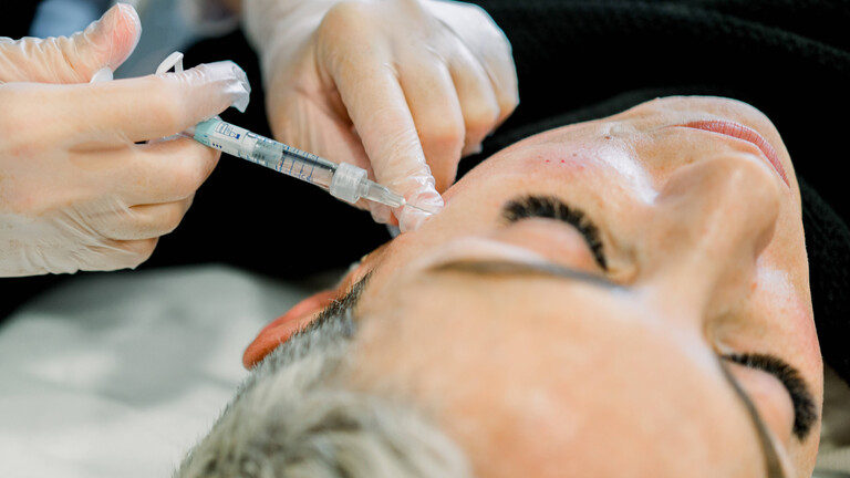 Eine Frau bekommt in einer ästethischen Behandlung Filler injiziert.