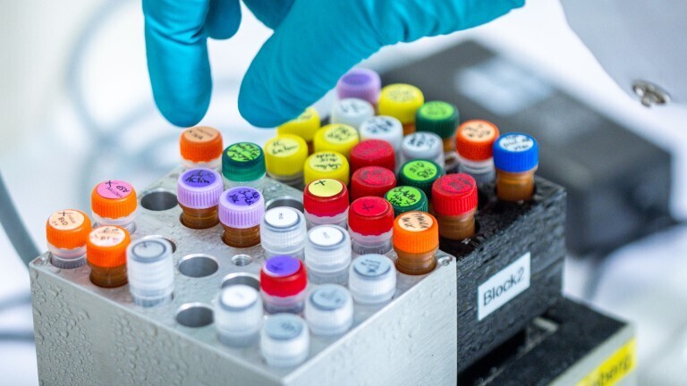 Unterschiedliche Substanzen stehen auf Kühlblöcken in einem PCR-Labor. Hier werden Proben für spezifische DNA- oder RNA-Tests vorbereitet. So können Erreger von Infektionskrankheiten wie Viren und Bakterien zuverlässig nachgewiesen werden.